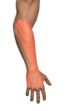 Wrist Extensors
